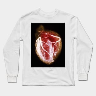 Coloured arteriogram of arteries of healthy heart (P216/0300) Long Sleeve T-Shirt